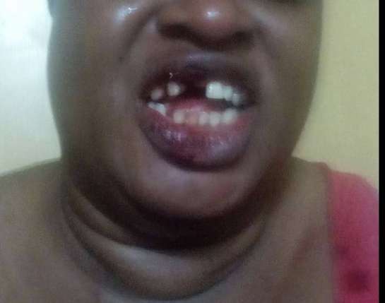 Image result for Nigeria Woman Teeth Knock off